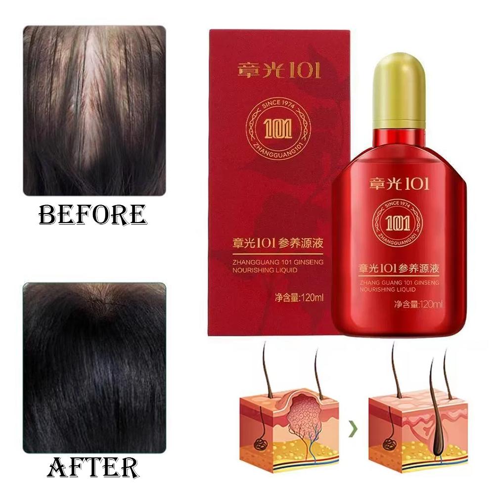 Zhang Guang 101 Formula (101P) - Hair Care Normal avis et prix