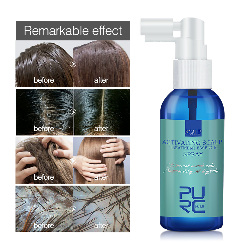PURC-Essence de Traitement du  - Hair Care Normal avis et prix
